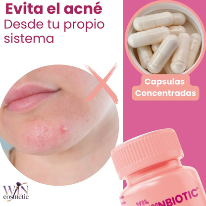 Vil SkynBiotic™ – El probiótico que controla el acne