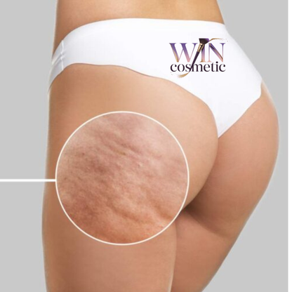 🔥 VIL CELULYTBIOTIC –Reduce la Celulitis